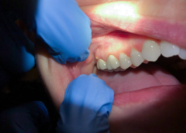 Best Broken or Cracked Tooth Emergency Dentist in Shamokin, PA