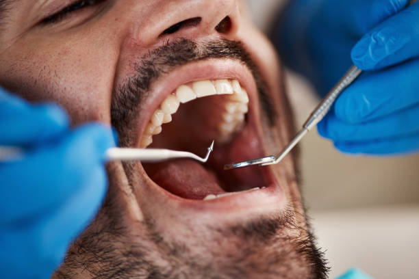 Best Emergency Dental Extractions in Shamokin, PA